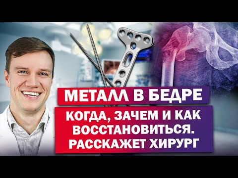 Видео: Остеосинтез бедра - что это такое и как это лечить?