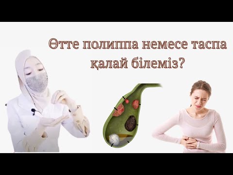 Видео: ӨТТЕ ПОЛИППА НЕМЕСЕ ТАСПА ҚАЛАЙ БІЛЕМІЗ. полип қалай пайда болады?