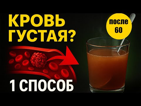 Видео: ПОЖИЛЫМ: Холодные кисти, «мушки» в глазах? Уберите 3 ошибки, что сгущают кровь