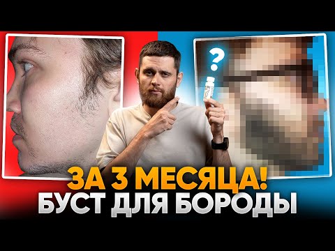 Видео: В 29 ЛЕТ НЕ РОСЛА БОРОДА / Результаты средства для роста бороды mr.Volos