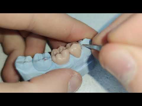 Видео: WAX UP. Учимся моделировать зуб. Как моделировать 2й премоляр нижней челюсти. Курс для начинающих