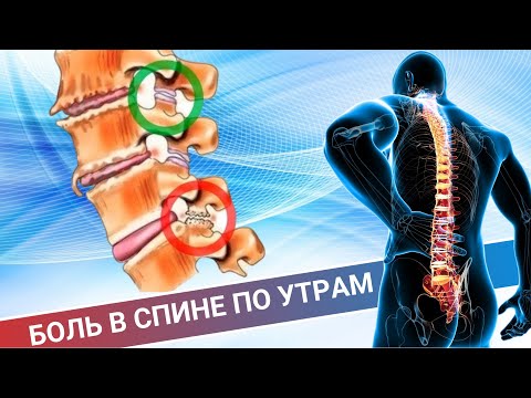 Видео: ТЯЖЕЛО УТРОМ ВСТАТЬ || БОЛИТ СПИНА