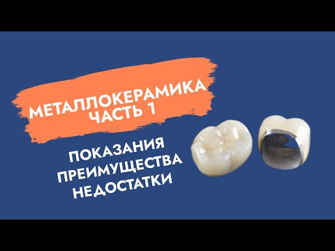 Видео: Металлокерамика (ч.1). Показания, преимущества, недостатки.