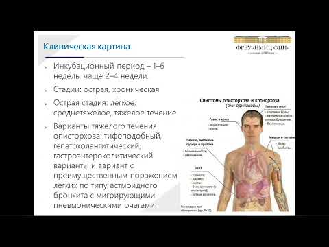 Видео: Описторхоз: клиника, диагностика, лечение