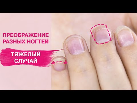 Видео: Я такого еще не встречала! | Случай просто жесть. Преображение