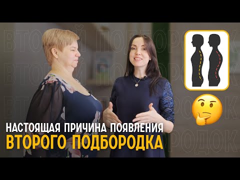 Видео: Показываю причины появления второго подбородка на живом примере