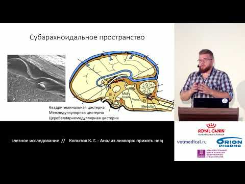 Видео: Копытов К. Г. - Анализ ликвора