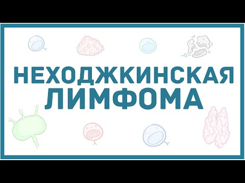 Видео: Неходжкинская лимфома - виды, причины, патогенез