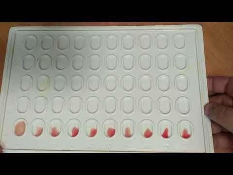 Видео: Определение титра антител к антигенам системы резус