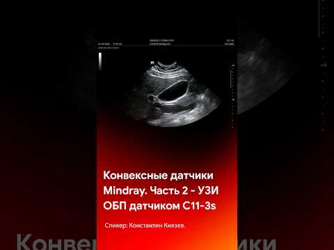 Видео: УЗИ органов брюшной полости датчиком Mindray C11-3s #shorts #short #tiktok #reels #узи #медицина