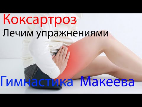 Видео: Коксартроз. Боль в Бедре. Быстрое избавление.