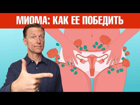 Видео: Миома матки: чем вы ее кормите? ЭТО остановит рост миомы🙌