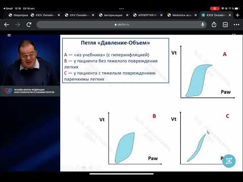 Видео: Аппарат ИВЛ