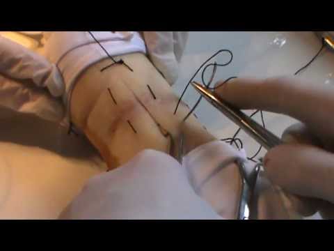 Видео: Хирургические непрерывные швы. Docent A.D. Stepanov, ПДАТУ