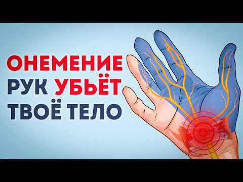 Видео: НЕМЕЮТ РУКИ и ПАЛЬЦЫ? Срочно сделай ЭТО, пока не поздно!