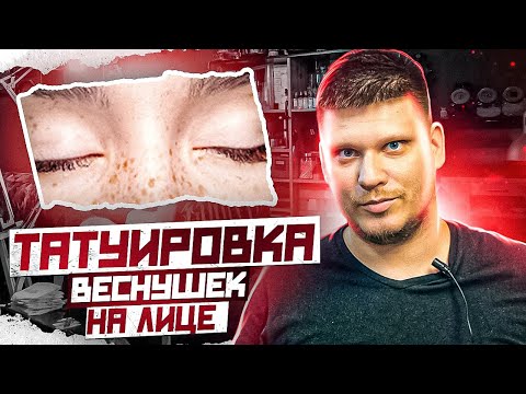 Видео: ТАТУ ВЕСНУШКИ! Дичь или нет? Как я делал татуировки веснушек на лице. Риски и профит.