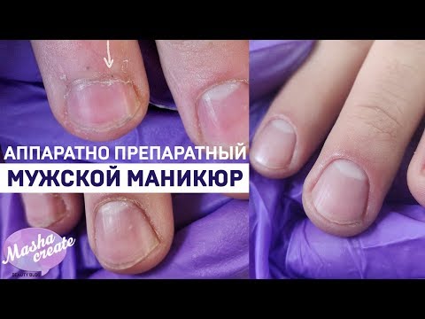 Видео: Аппаратно-Препаратный маникюр. Мужской маникюр - слоящаяся кожа грубая кутикула.