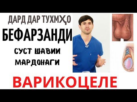 Видео: Варикоцеле - кадом вакт бояд чаррохи кунем?