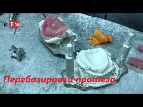 Видео: Перебазировка зубного протеза | Denture rebase