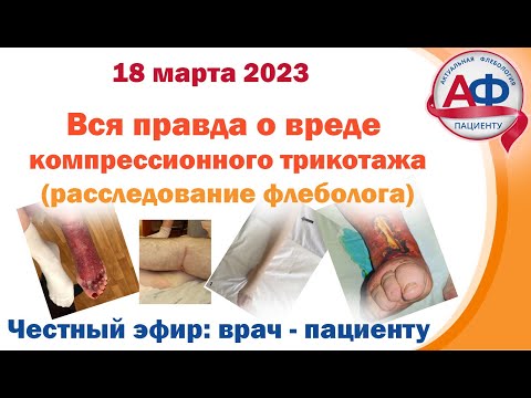 Видео: Правда о вреде компрессионного трикотажа расследование флеболога