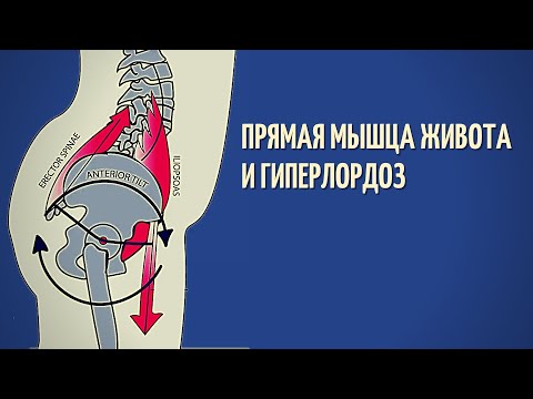 Видео: ПРЯМАЯ МЫШЦА ЖИВОТА (ПРЕСС) И ГИПЕРЛОРДОЗ