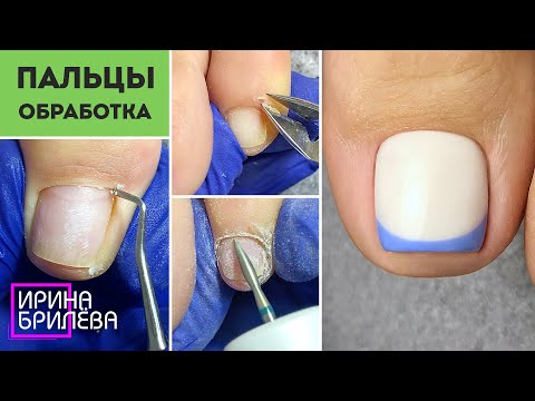 Видео: Педикюр 🌸 Обработка пальцев 🌸 Покрытие гель лаком 🌸 Ирина Брилёва