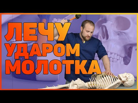 Видео: ЛЕЧУ УДАРОМ МОЛОТКА | ПОСЛЕДСТВИЯ