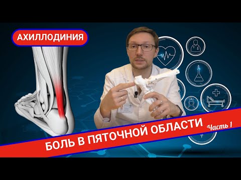 Видео: ПОЧЕМУ БОЛИТ В ОБЛАСТИ ПЯТКИ? АХИЛЛОДИНИЯ. (Часть 1)