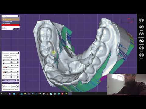 Видео: Изготовление окклюзионной шины в цс, параметры артикулятора. Латеротрузия, протрузия.