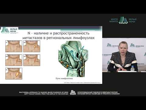 Видео: Рак языка – первичная МР-диагностика и оценка эффективности проведенного лечения (Пономарева О.И.)