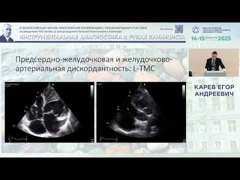 Видео: Взрослый пациент со сложным врождённым пороком сердца: подводные камни эхокардиографии