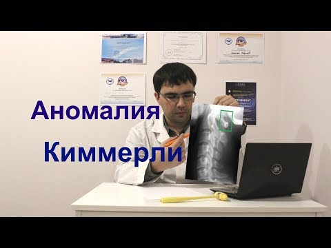 Видео: Аномалия Киммерли