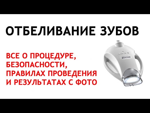 Видео: Отбеливание зубов Zoom 4 (Zoom! WhiteSpeed). Все этапы отбеливания + фото до и после. Безопасность.