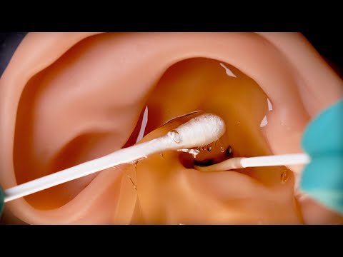 Видео: [Удовлетворительное видео] ASMR / помочь залитым ушам жидким клеем | Сбой микрофона, ACMP