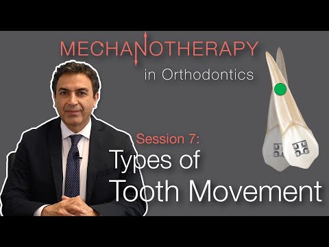 Видео: Механотерапия в ортодонтии: виды перемещения зубов. Часть 1