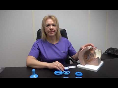 Видео: Пессарии силиконовые Симург. Подбор размера различными способами.