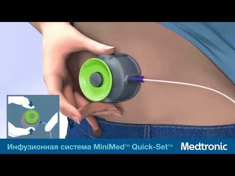 Видео: Инфузионный набор Quick-Set