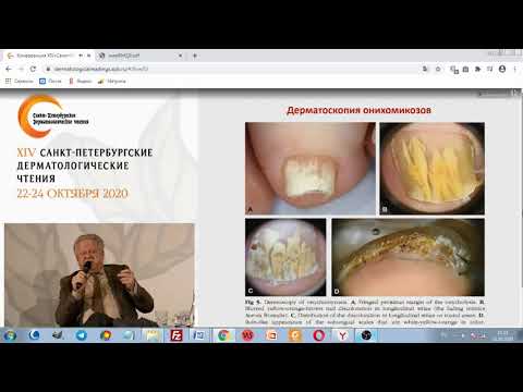 Видео: Лечение микозов в современных клинических рекомендациях