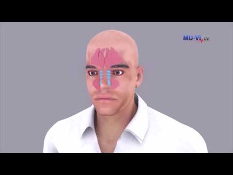 Видео: Синузит   какво все още не сме научили за него