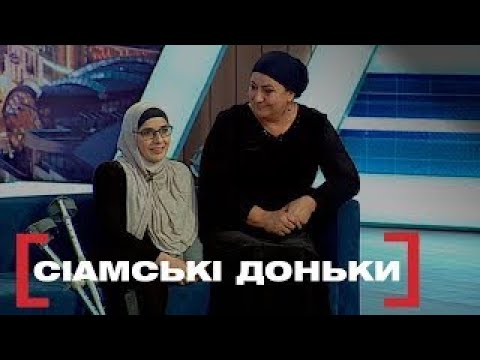 Видео: ДВІ ГОЛОВИ Й ОДНЕ ТІЛО | ТАК ВИРІШИЛА ПРИРОДА | Стосується кожного