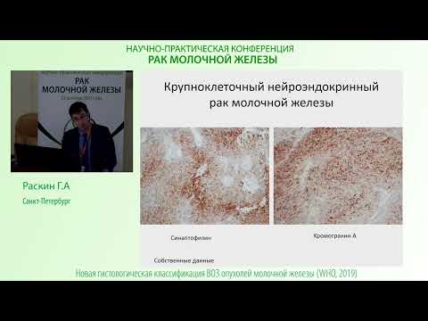 Видео: Нейроэндокринные опухоли молочной железы