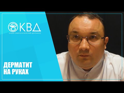 Видео: 1228  Дерматит на руках