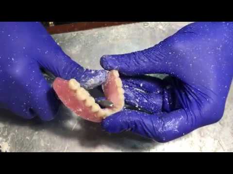 Видео: Как починить сломанный протез. Repair of denture