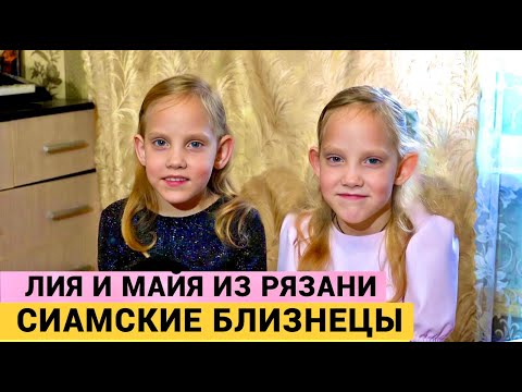 Видео: ОНИ ЖЕ СРОСЛИСЬ, А НЕ ОБНИМАЮТСЯ! - ахнула доктор на УЗИ. Сиамским близнецам идет 9 год.