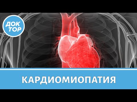 Видео: Кардиомиопатия. Кто в группе риска