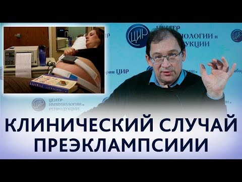 Видео: Преэклампсия. Разбор клинического случая тяжёлой преэклампсии беременных. Отвечает доктор Гузов.