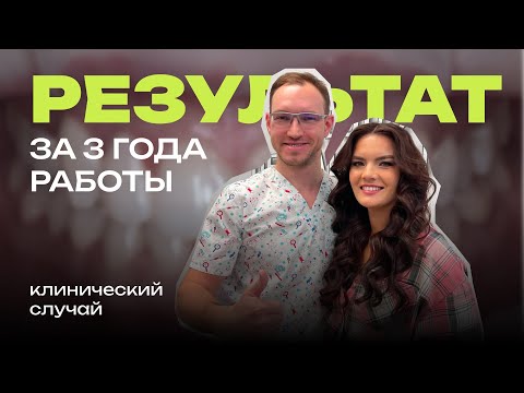 Видео: Элайнеры 3 года. Имплантация, отбеливание зубов. Результат ТОП. Стас Белоус Стоматолог Ульяновск
