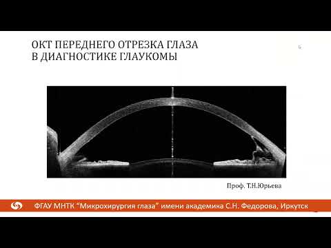 Видео: Запись вебинара. ОКТ переднего отрезка глаза. Юрьева Т.Н.