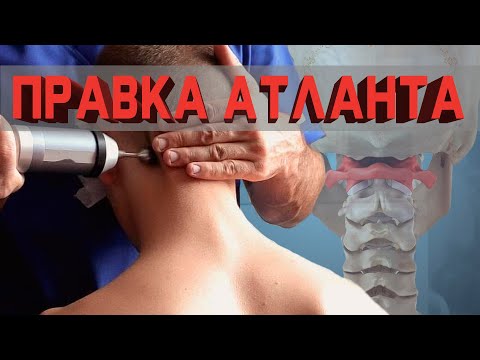 Видео: Правка атланта зло или добро?