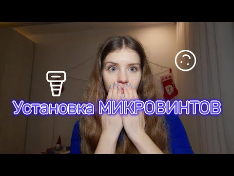 Видео: Мой опыт установки МИКРОИМПЛАНТОВ🔩| Боль🥲| Как прошли несколько дней?